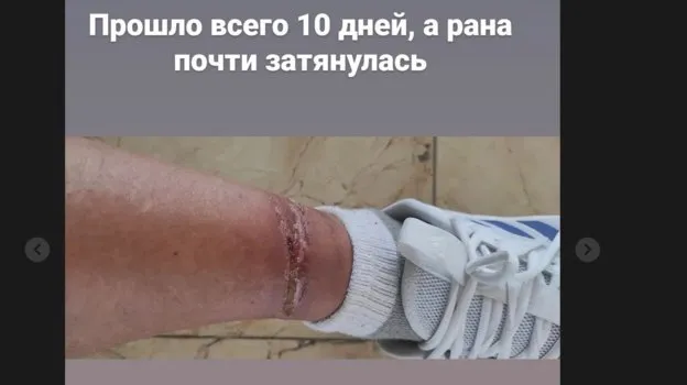 сториз Олега Тактарова