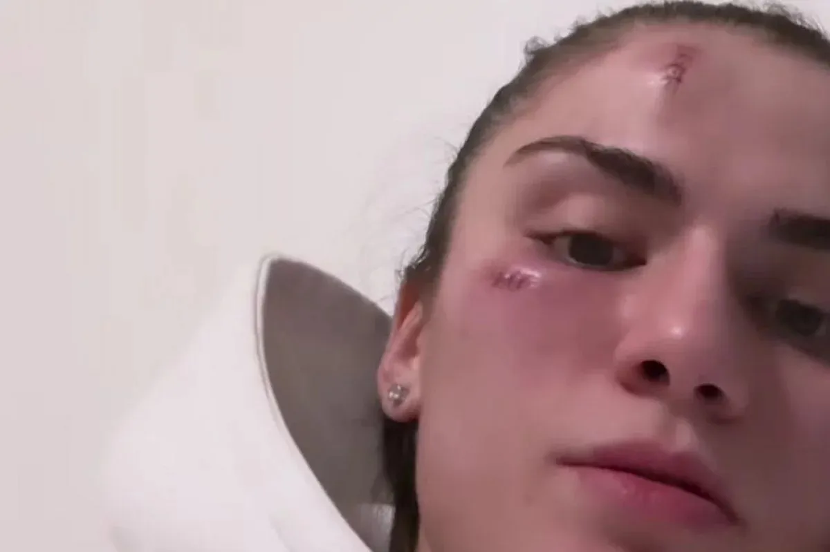 Аминат Эльбукаева