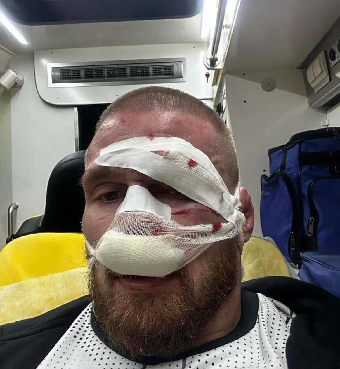Артем Резников после боя