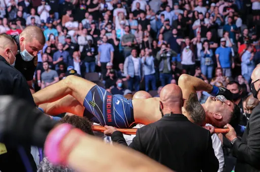 Сломавший ногу на UFC 261, Крис Вайдман показал рентгеновские снимки ноги