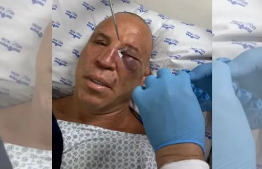 Вандерлея Силву госпитализировали после драки на вечере бокса в Бразилии