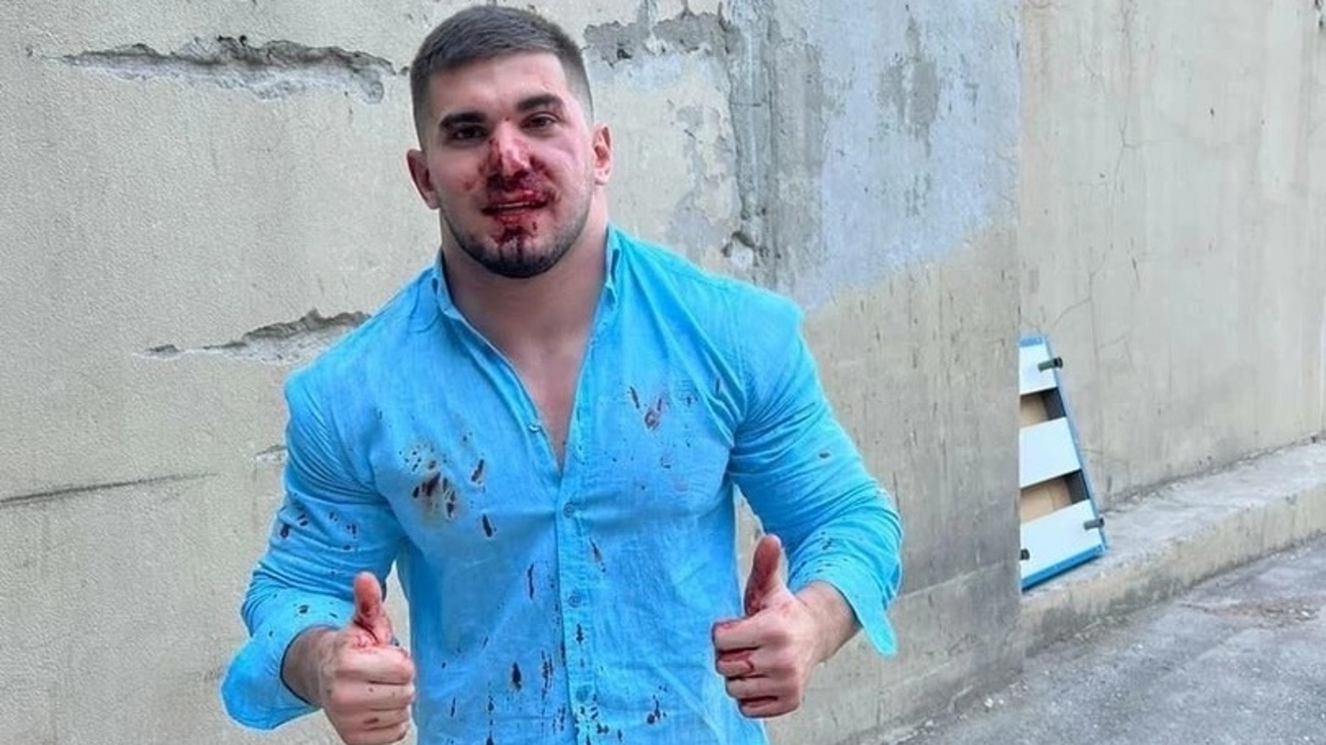 Асхаб Тамаев после драки в Дагестане
